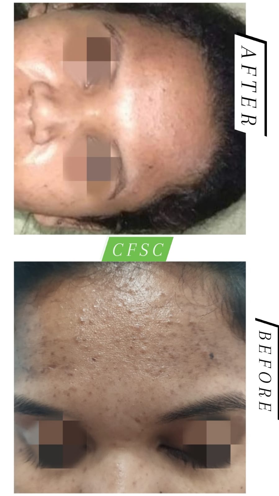 Before After Hair Treatment